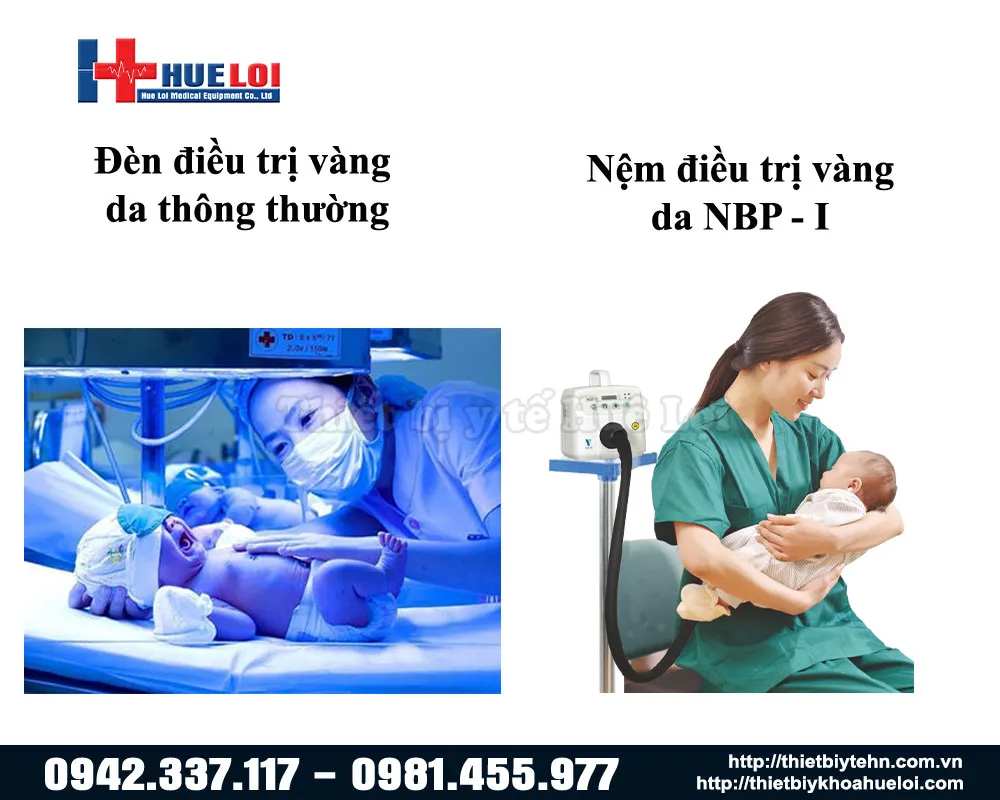 Hình ảnh thực tế điều trị vàng da bằng chăn NBP-I