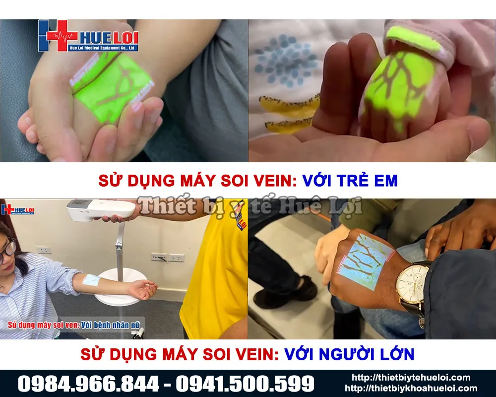 Máy chiếu tìm tĩnh mạch QV-600
