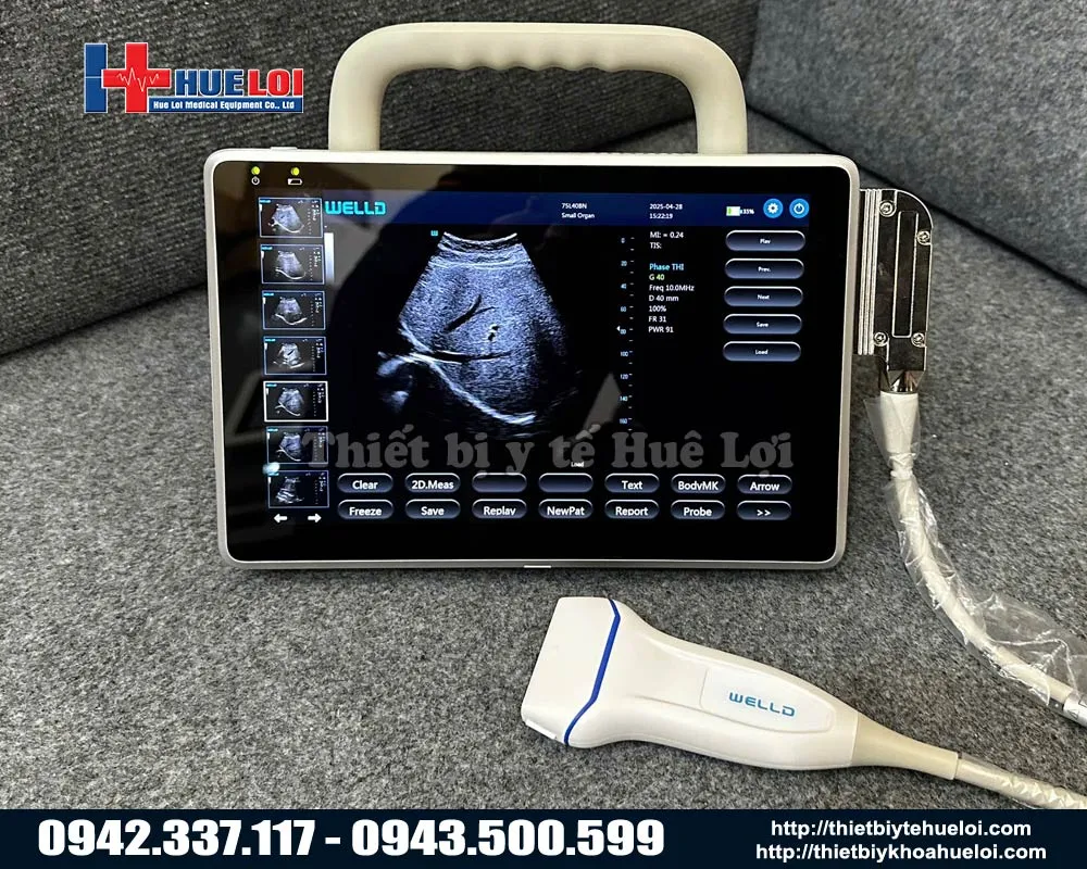 MÁY SIÊU ÂM HÌNH ẢNH KHÔNG DÂY GIÁ RẺ WELL.D P10