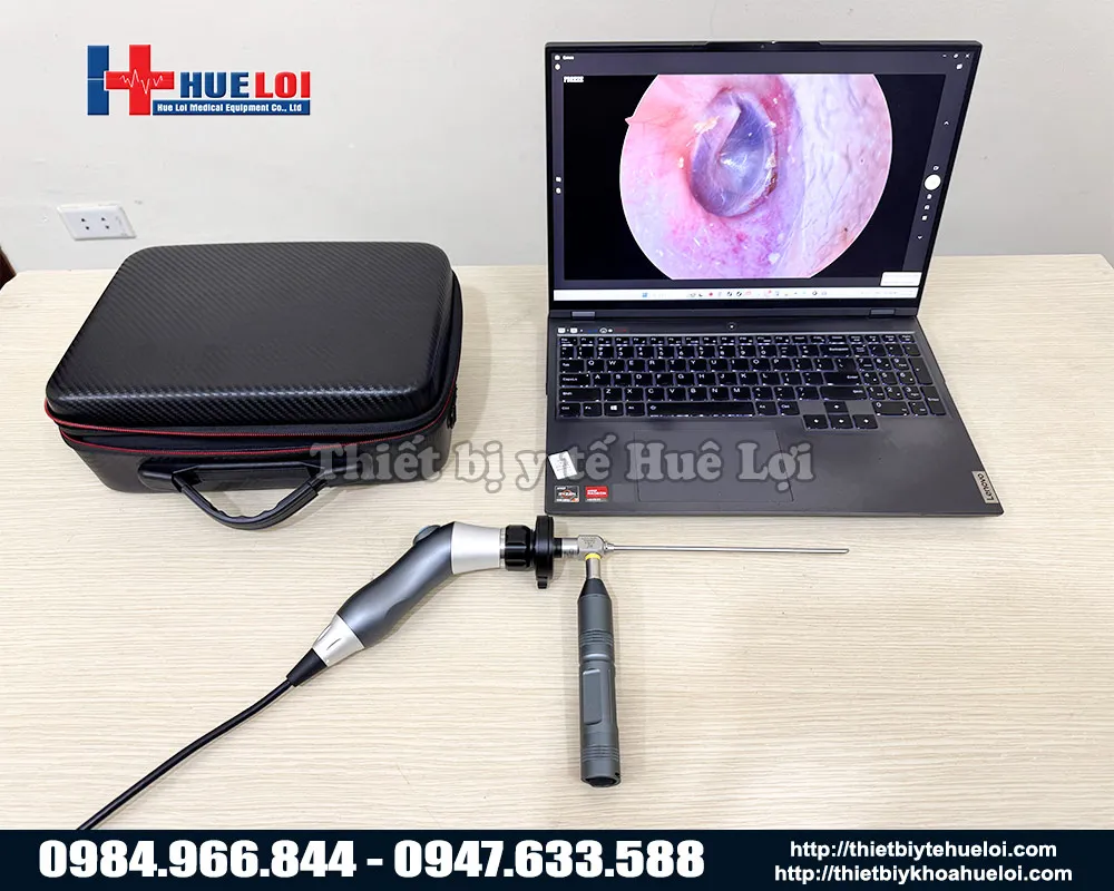 Máy nội soi tai mũi họng mini full HD