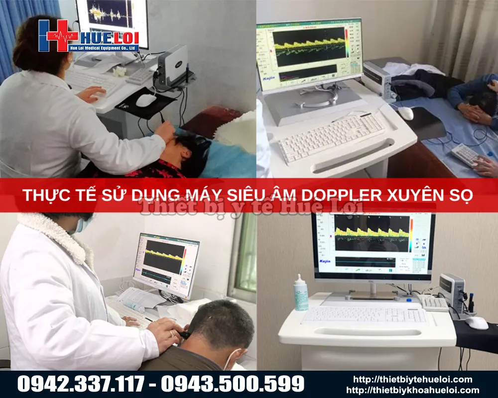 Ứng dụng của máy siêu âm xuyên sọ
