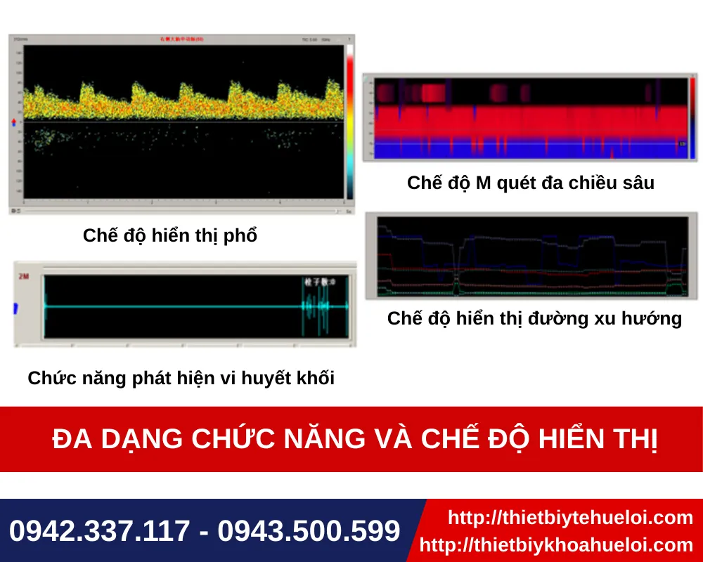 Máy siêu âm doppler xuyên sọ thế hệ mới