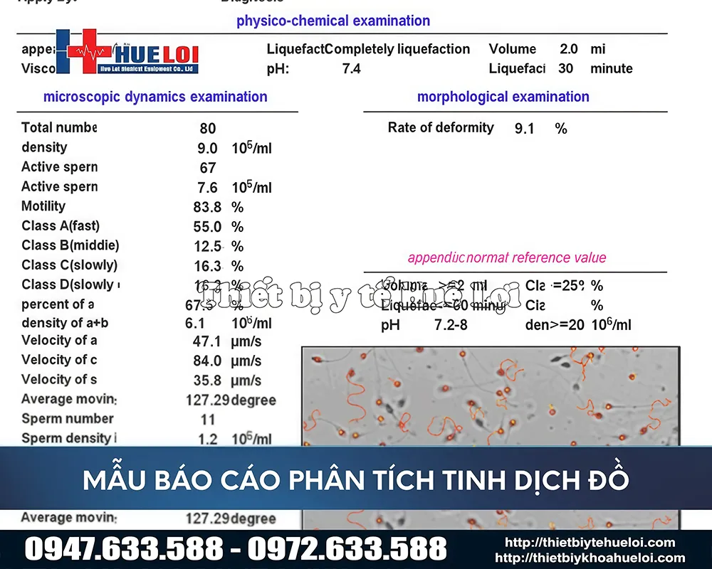 Bảng báo cáo chất lượng tinh trùng thông qua máy phân tích tinh trùng