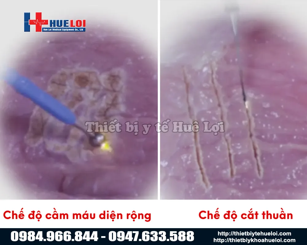 Chế độ nổi bật của dao mổ điện đơn cực thú y