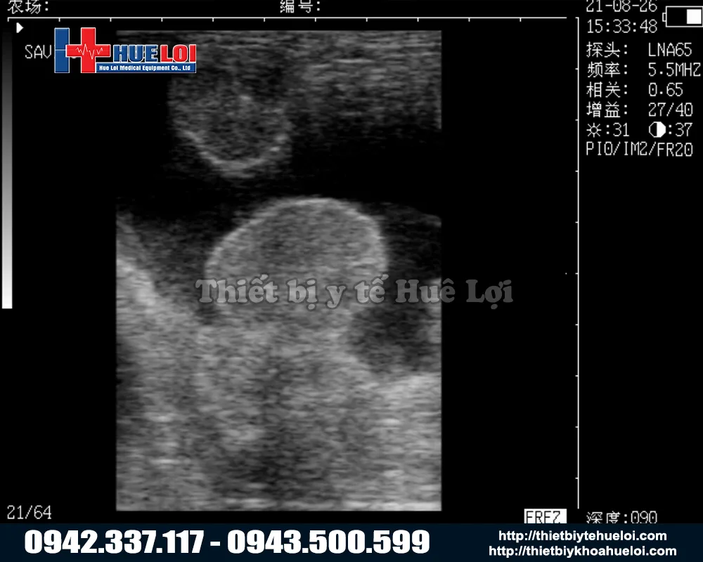 Máy siêu âm thai cho lợn di động giá rẻ