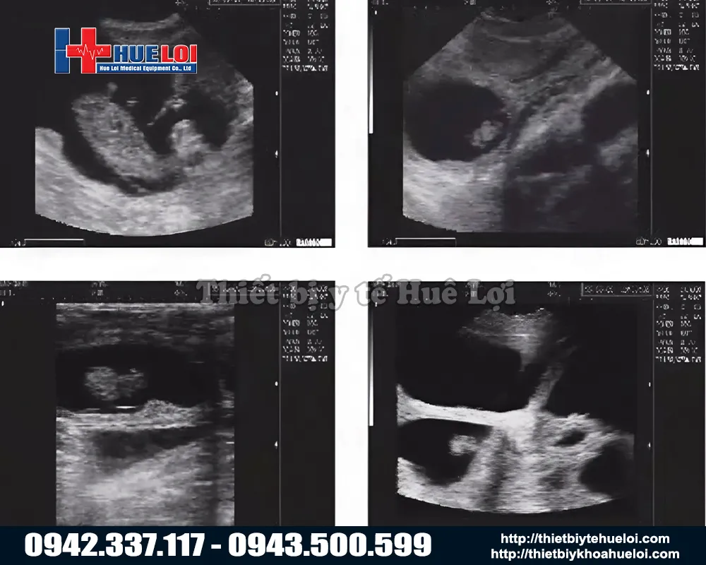 Máy siêu âm chẩn đoán trang trại di động dành cho heo chuyên dụng