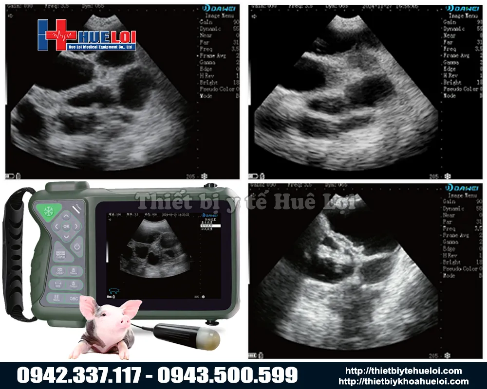 Máy chẩn đoán thai di động giá rẻ dành riêng cho trang trại lợn