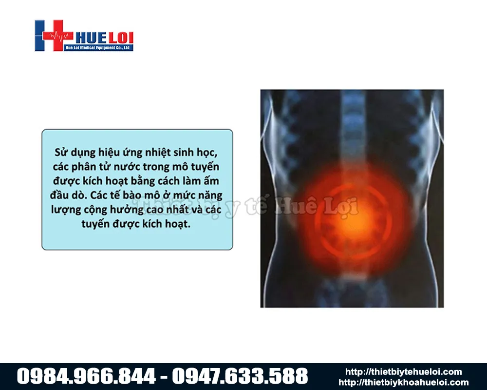 C&ocirc;ng nghệ nhiệt trị liệu của m&aacute;y điều trị tuyến tiền liệt