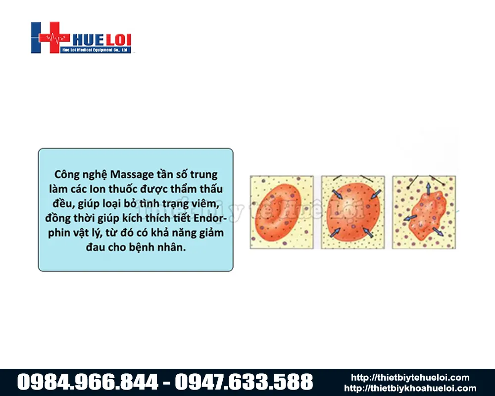 C&ocirc;ng nghệ massage m&aacute;y điều trị bệnh tuyến tiền liệt