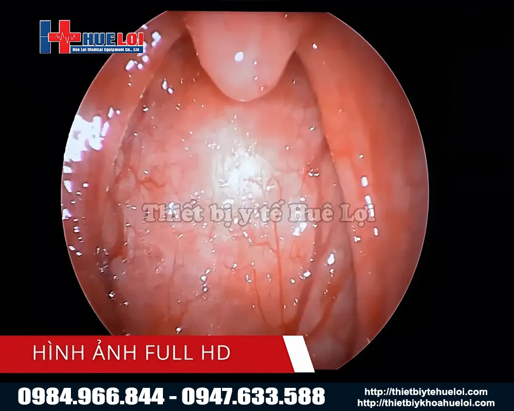 Chất lượng hình ảnh máy nội soi tai mũi họng full hd tj168b