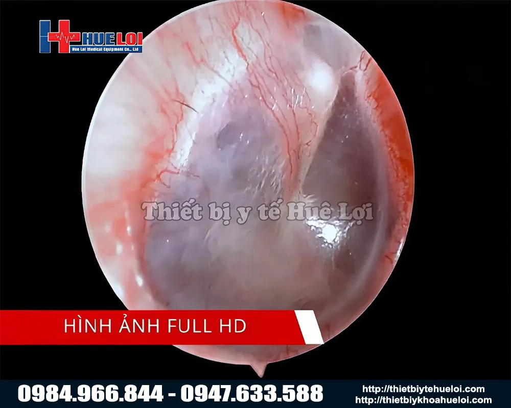 Chất lượng máy nội soi tai mũi họng full hd tj-168b