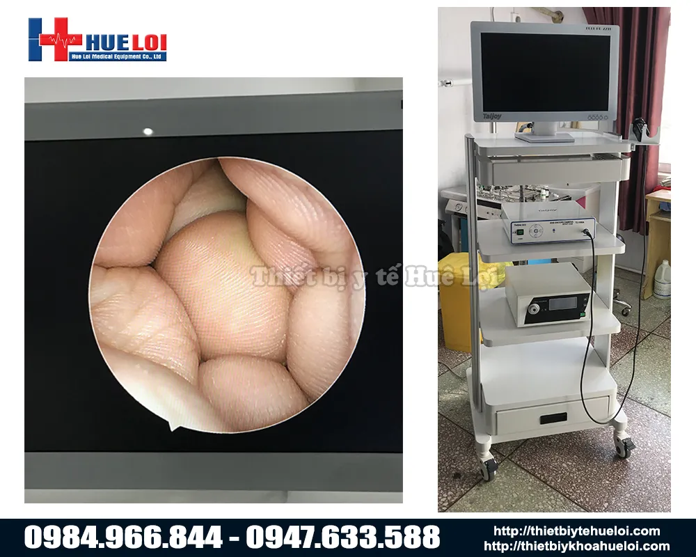 M&aacute;y nội soi tai mũi họng SD TJ-168A