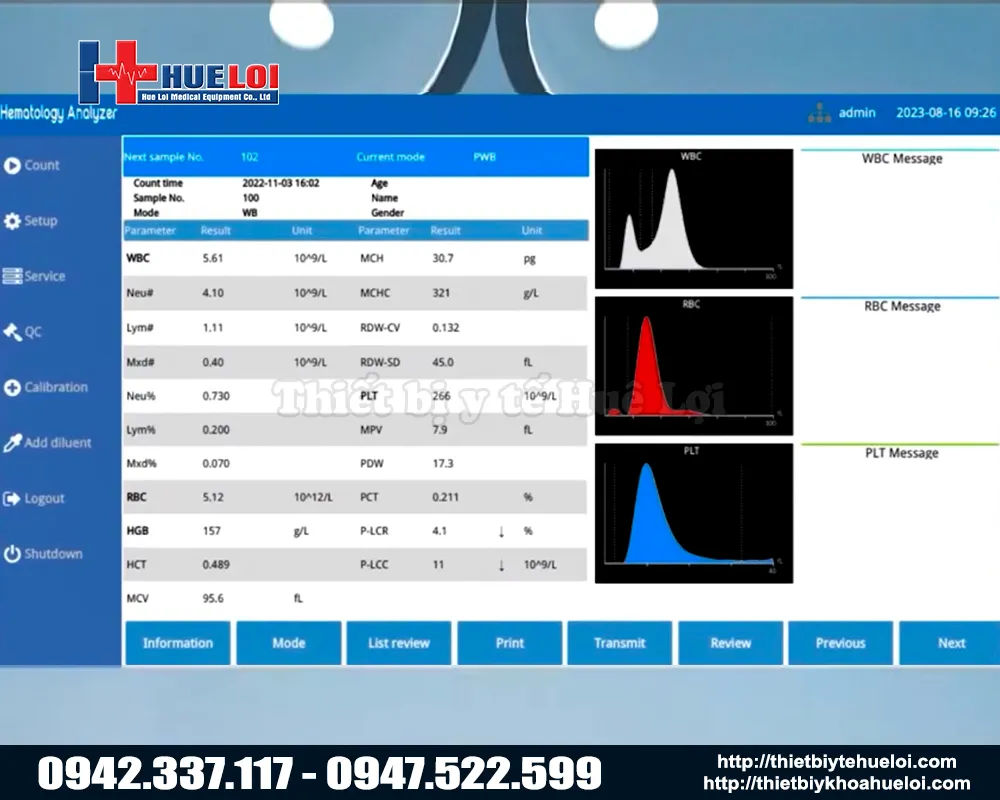 M&agrave;n h&igrave;nh kết quả ph&acirc;n t&iacute;ch của m&aacute;y x&eacute;t nghiệm huyết học 3 th&agrave;nh phần bha 3000 vet