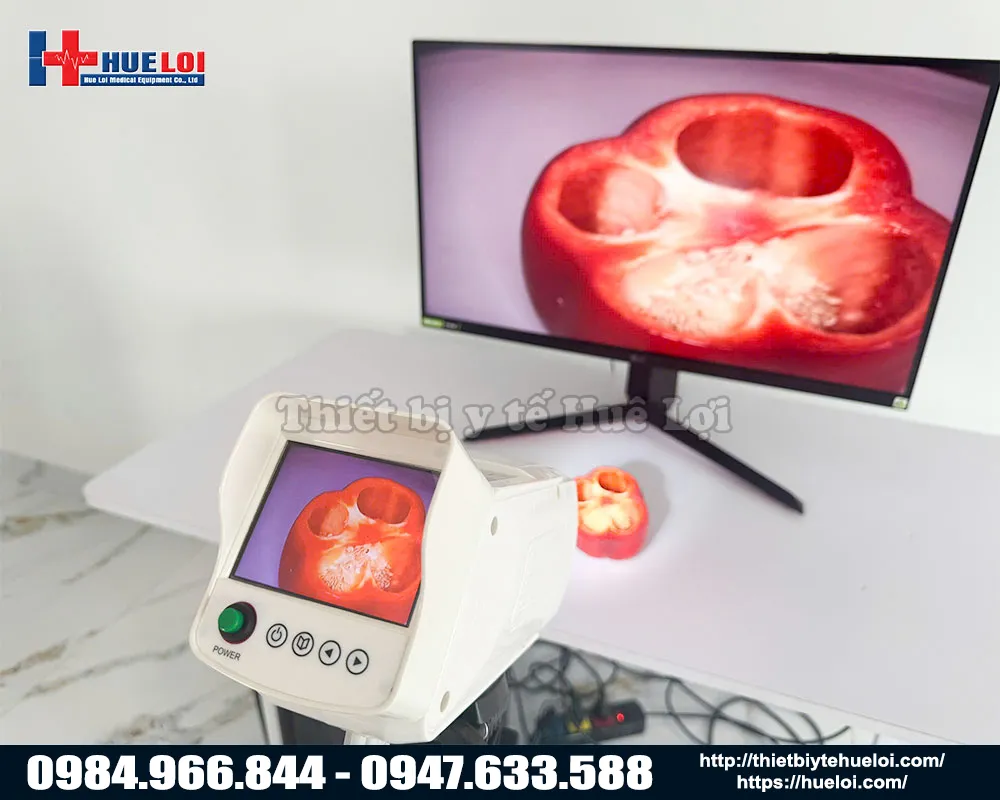 M&aacute;y soi cổ tử cung full hd SW-304