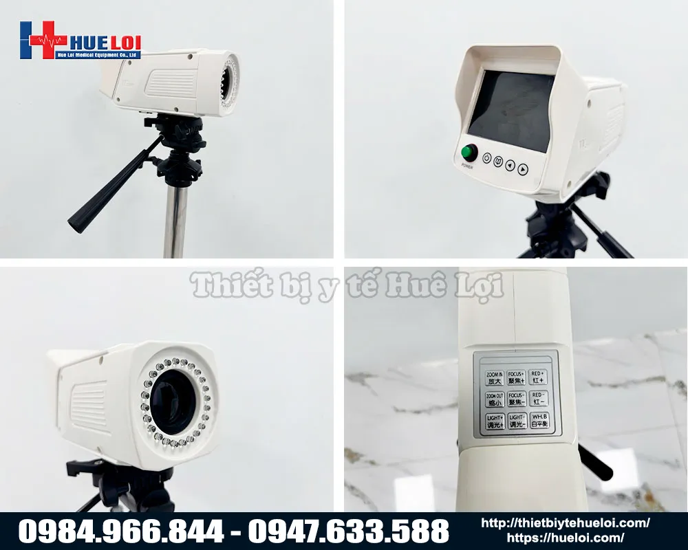M&aacute;y soi cổ tử cung full hd cao cấp gi&aacute; rẻ sw304