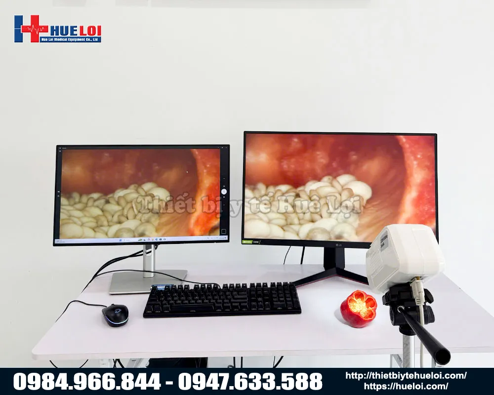 Chất lượng h&igrave;nh ảnh m&aacute;y soi cổ tử cung cao cấp sd sw302