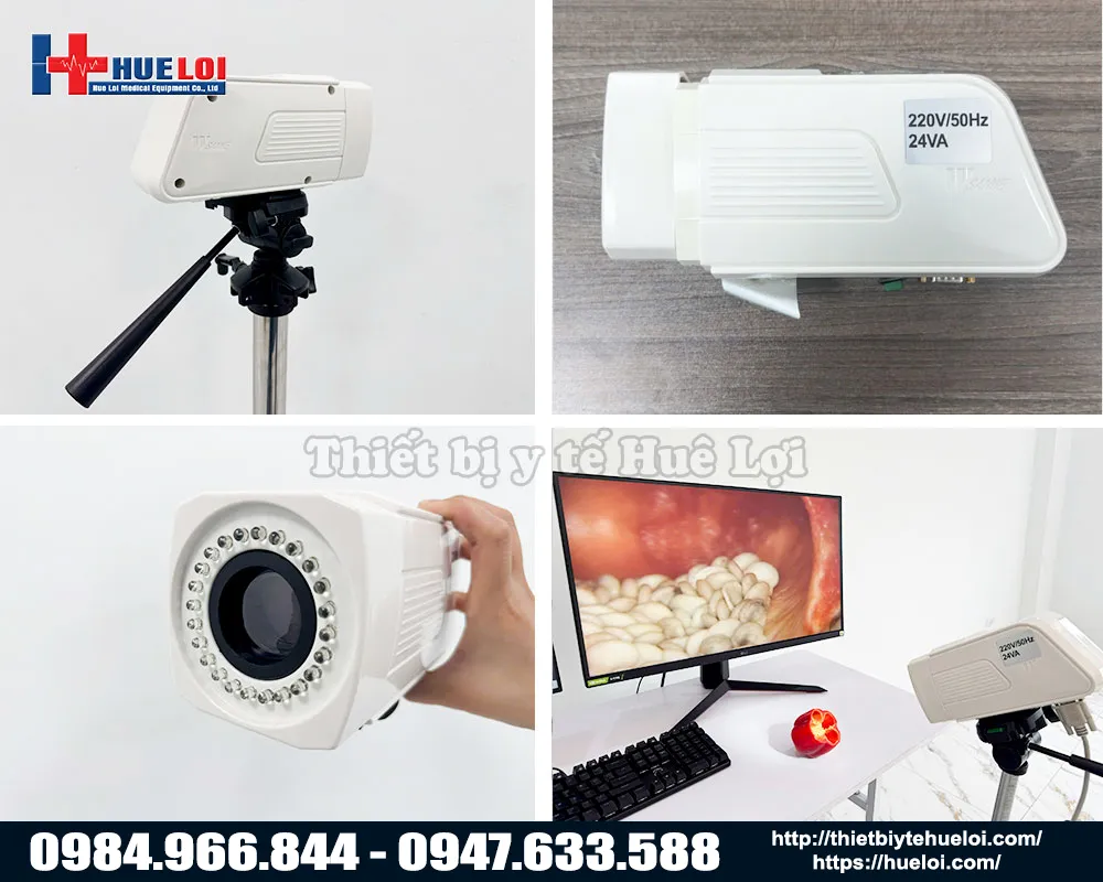 Chất lượng h&igrave;nh ảnh m&aacute;y soi cổ tử cung sanwe gi&aacute; rẻ