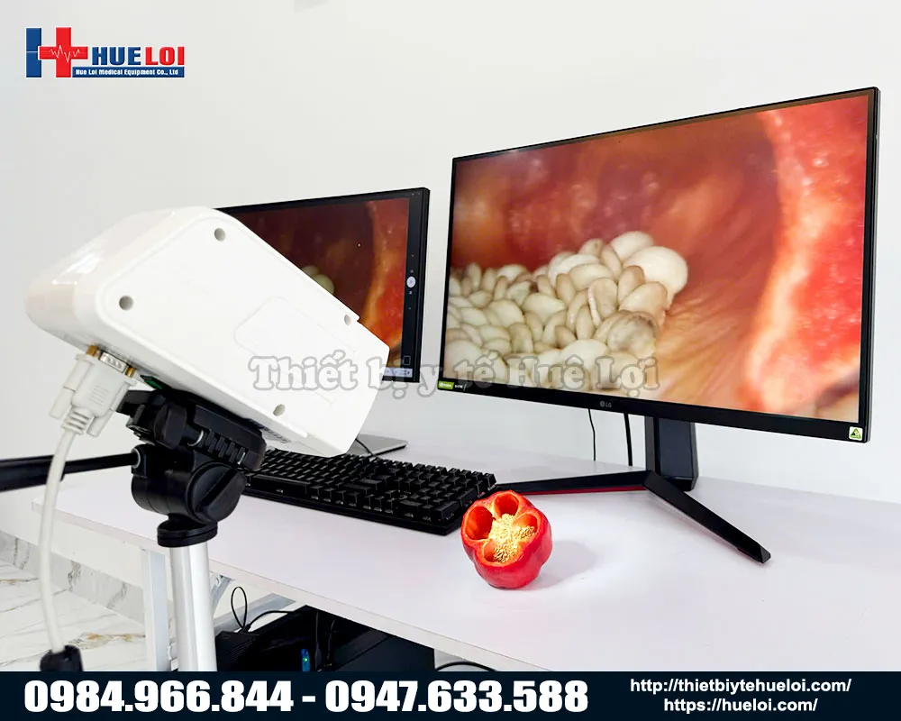 MÁY SOI CỔ TỬ CUNG SD SW302 CAO CẤP