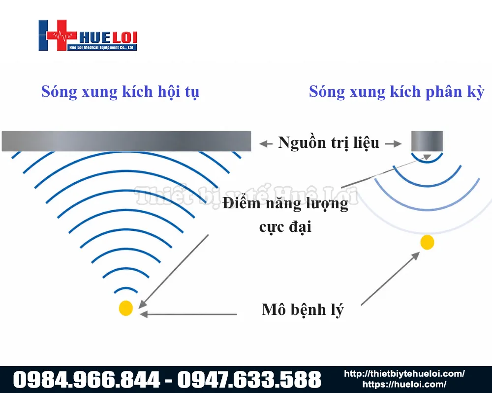 Nguy&ecirc;n l&yacute; hoạt động của s&oacute;ng xung k&iacute;ch hội tụ so với ph&acirc;n k&igrave;