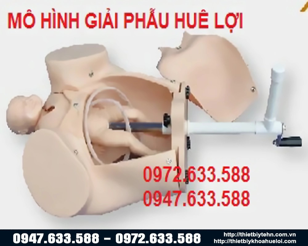 Mô hình đỡ đẻ