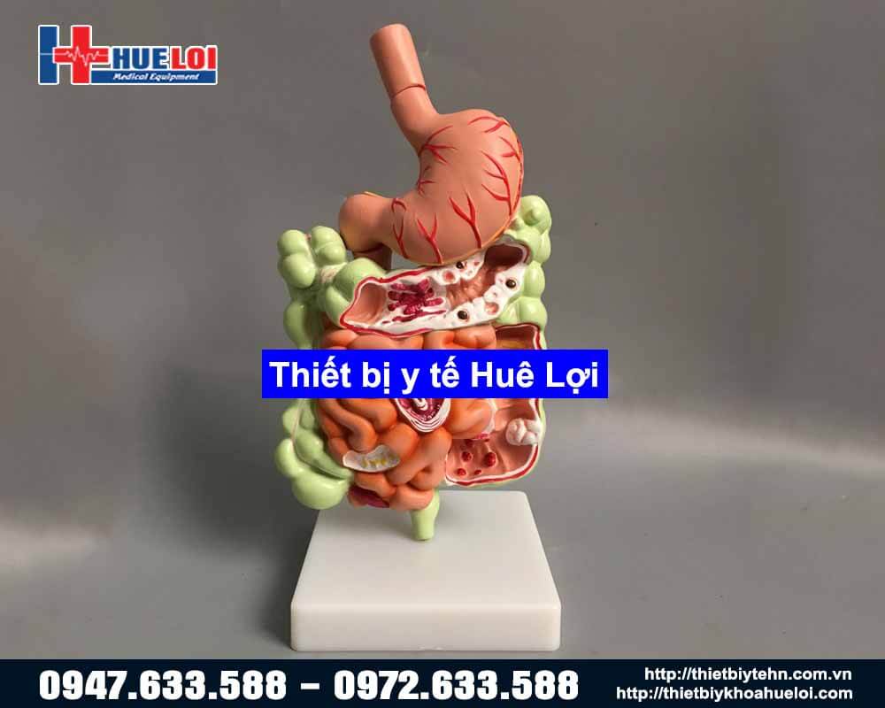 Mô hình bóc tách hệ tiêu hóa người