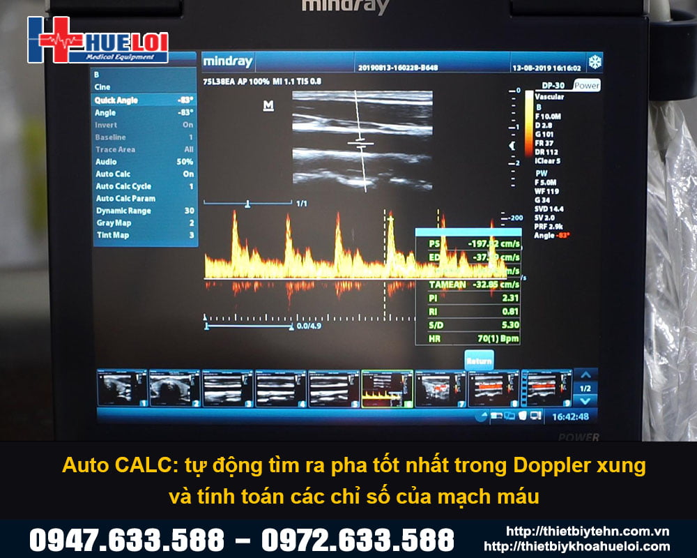 Mindray-DP-30