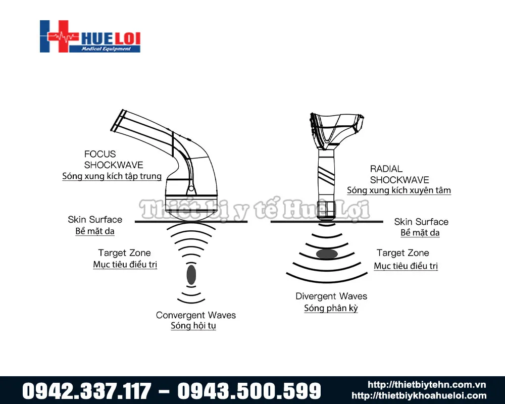 Hình ảnh nguyên lý tác động của hai loại sóng xung kích