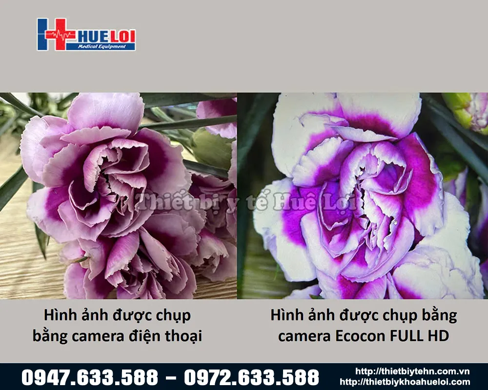 So sánh chất lượng hình ảnh thực tế chụp bằng điện thoại và bằng máy soi cổ tử cung Ecocon FULL HD